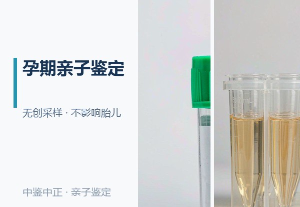 河南胎儿亲子鉴定机构在哪里有,河南孕期亲子鉴定预约流程